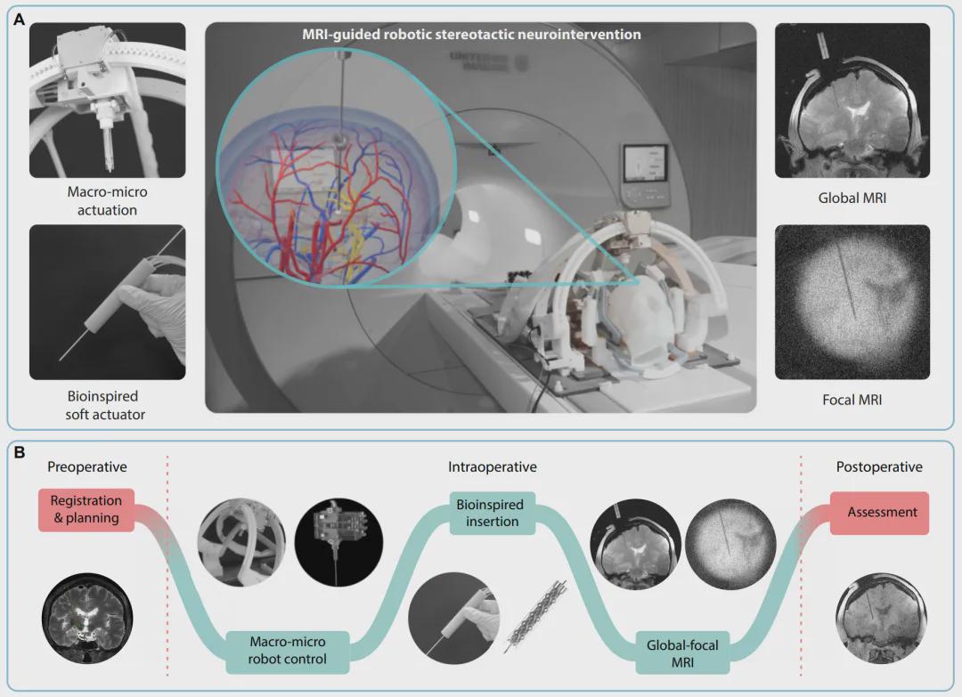 国家专项新突破！中国团队自主研发核磁兼容手术机器人，实现亚毫米级精度！(图3)