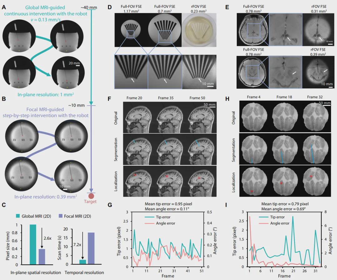 国家专项新突破！中国团队自主研发核磁兼容手术机器人，实现亚毫米级精度！(图6)