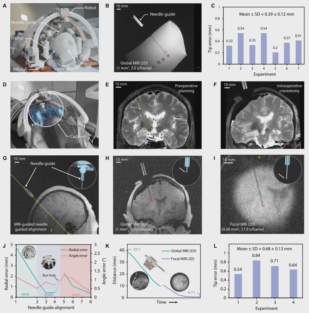 国家专项新突破！中国团队自主研发核磁兼容手术机器人，实现亚毫米级精度！(图7)