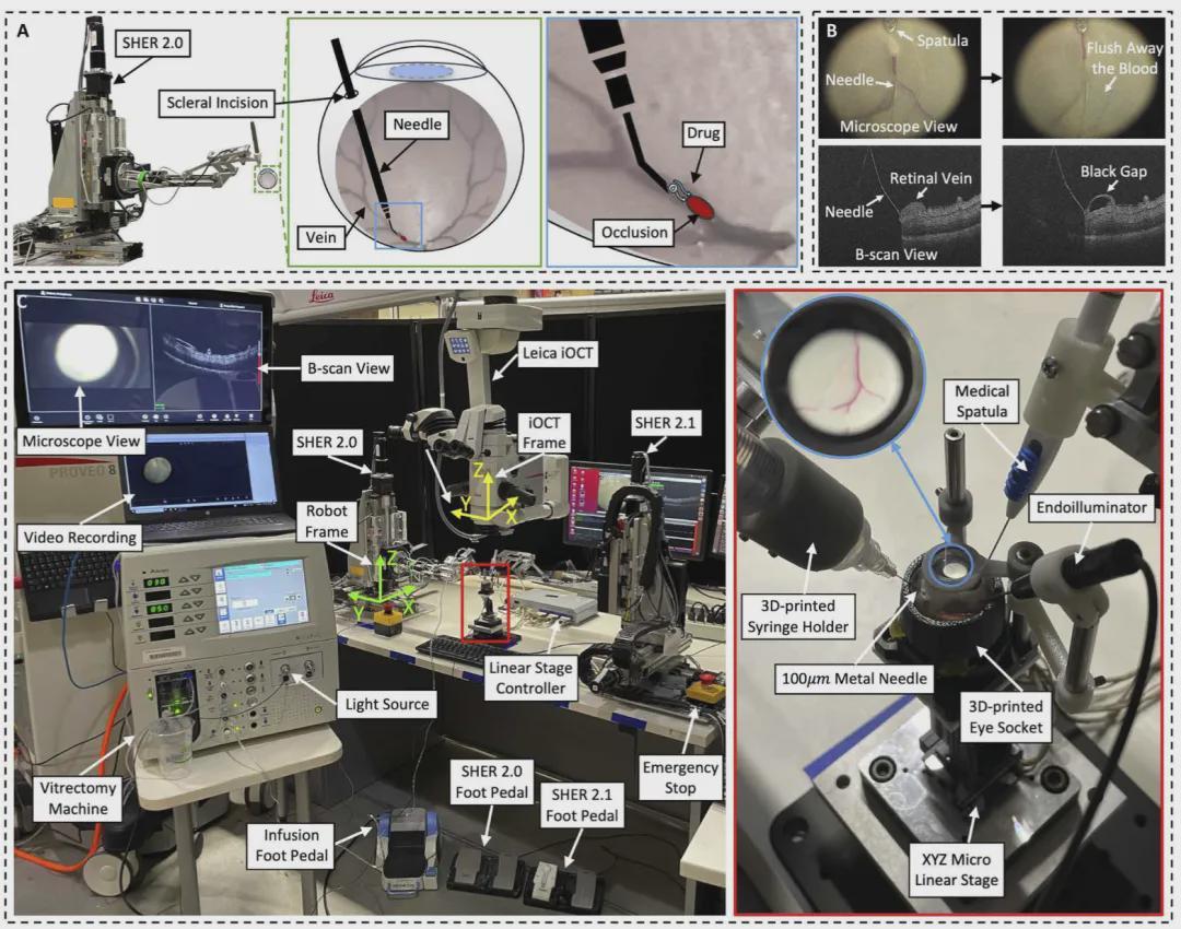 顶刊重磅！失明患者新希望！机器人自主视网膜静脉插管系统来了(图2)