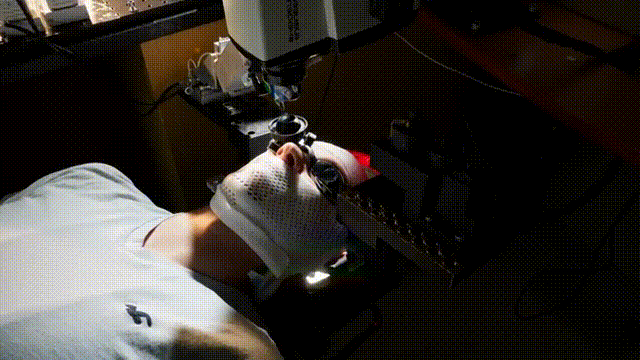 Science子刊：成功率100%？头戴式手术机器人实现眼科手术"动态零误差"(图1)